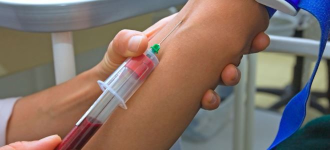 гликозилированный гемоглобин как сдавать гликозилированный гемоглобин как сдавать