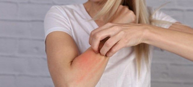 крем элидел показания к применению крем элидел показания к применению