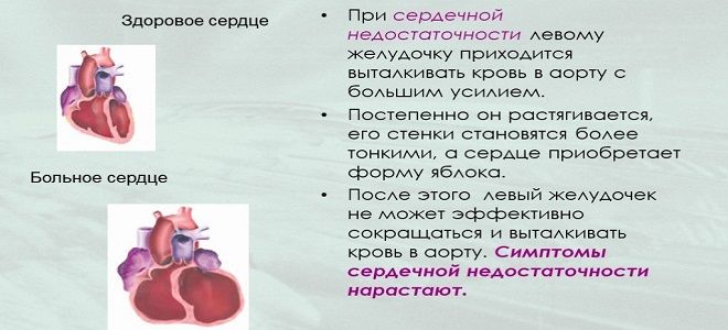 лекарства при сердечной недостаточности лекарства при сердечной недостаточности
