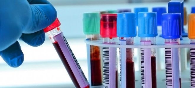 липидограмма что это за анализ липидограмма что это за анализ