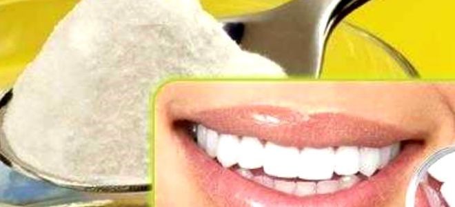 можно ли отбеливать зубы содой можно ли отбеливать зубы содой