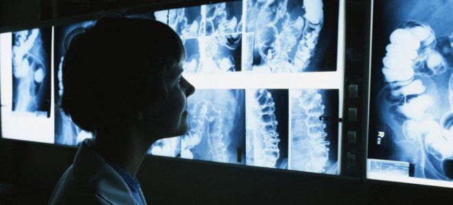 Причины появления лучевой болезни Причины появления лучевой болезни