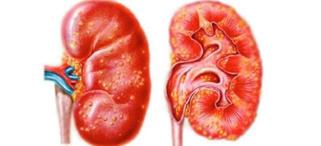 фото1 применение уролесан