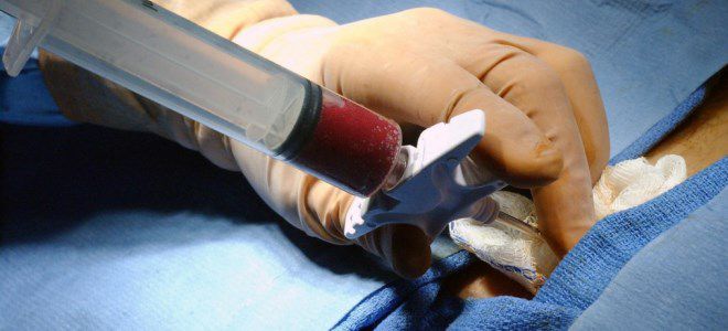 стволовые клетки крови стволовые клетки крови