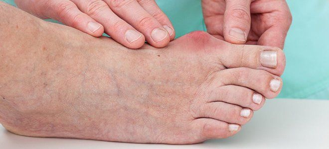 фото1 таблетки амелотекс от спины