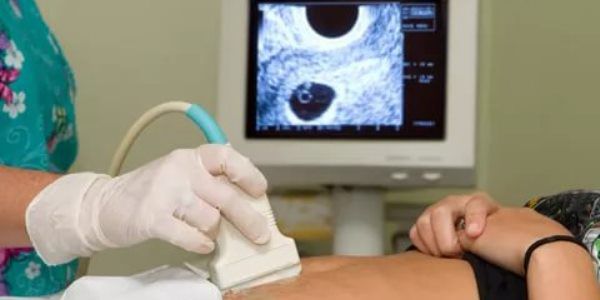 трубный аборт лечение трубный аборт лечение