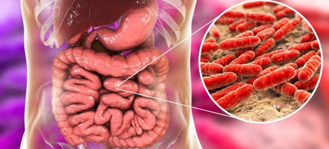 воспаление кишечника причины воспаление кишечника причины