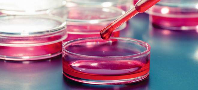 Антифосфолипидный синдром анализ Антифосфолипидный синдром анализ