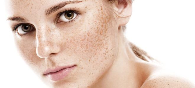 болтушка от пигментных пятен на лице болтушка от пигментных пятен на лице