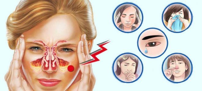 чем опасен аллергический ринит чем опасен аллергический ринит