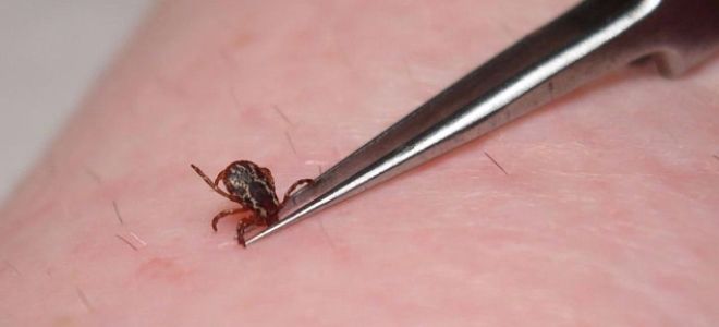 чем опасен укус клеща чем опасен укус клеща