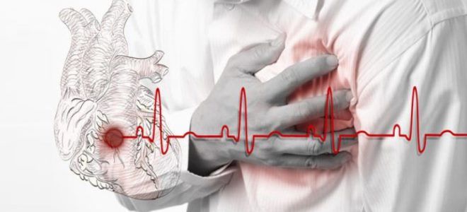 чем опасна артериальная гипотензия чем опасна артериальная гипотензия