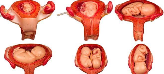 чем опасна двурогая матка чем опасна двурогая матка