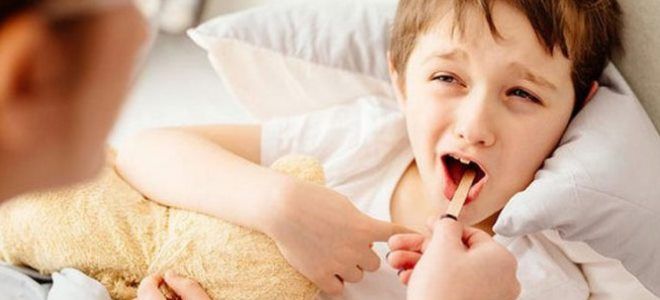герпесная ангина это герпесная ангина это