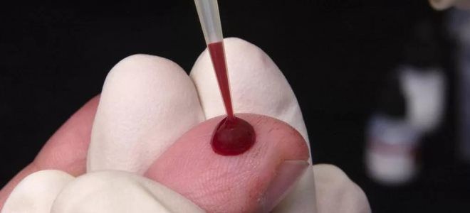 густая кровь как разжижать густая кровь как разжижать