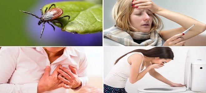 иммуноглобулин от энцефалита иммуноглобулин от энцефалита