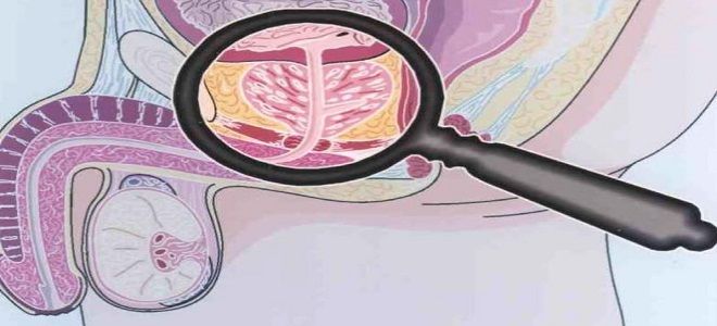 фото2 канефрон при простатите