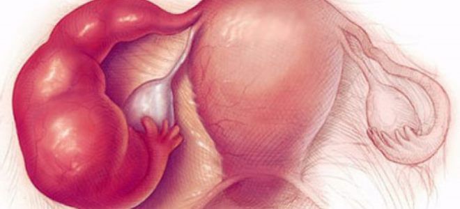 кетонал в суппозиториях кетонал в суппозиториях