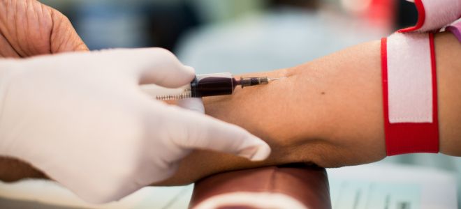 липидограмма как сдавать анализ липидограмма как сдавать анализ