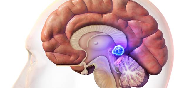 мелкая киста эпифиза мелкая киста эпифиза