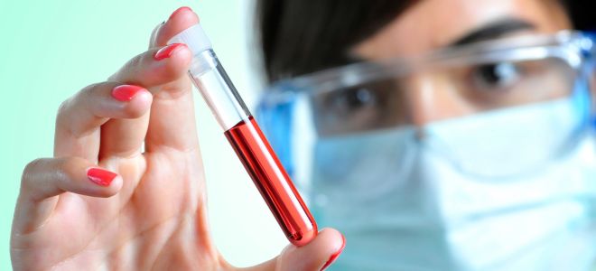 определение гликозилированного гемоглобина определение гликозилированного гемоглобина