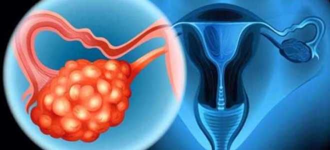 пункция яйцеклеток при эко пункция яйцеклеток при эко