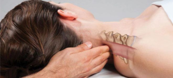 растяжение мышц шеи растяжение мышц шеи