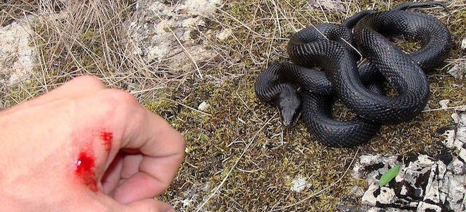 укус гадюки симптомы укус гадюки симптомы