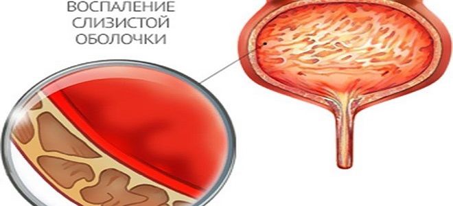 фото2 уролесан капли это