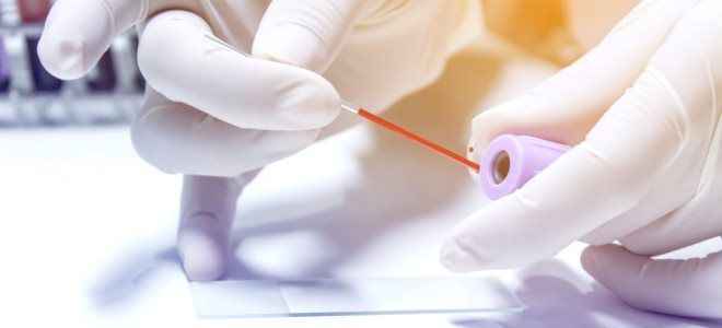 высокий гематокрит высокий гематокрит