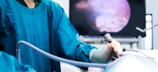 Аппендицит операция Аппендицит операция