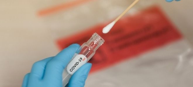 через сколько готов мазок на коронавирус через сколько готов мазок на коронавирус