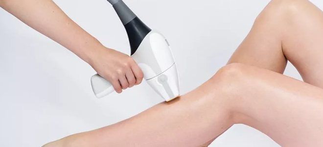 как делают фотоэпиляцию как делают фотоэпиляцию