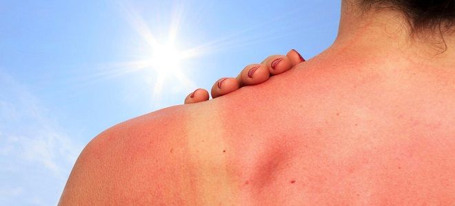 лучший пантенол от ожогов лучший пантенол от ожогов