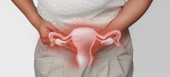 оофорит симптомы оофорит симптомы