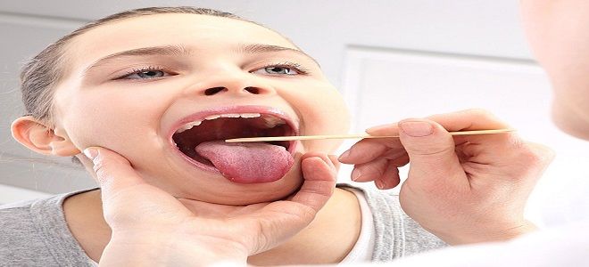 фото3 постоянная сухость в горле