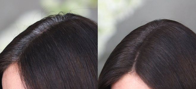 Варианты окрашивания седых волос раз Варианты окрашивания седых волос раз