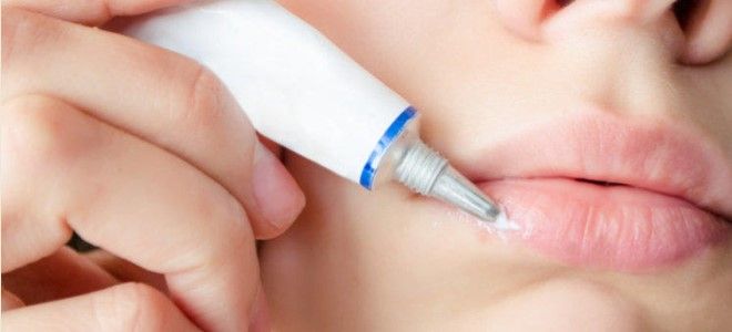 герпес на губах что делать герпес на губах что делать