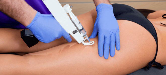 инъекционная карбокситерапия инъекционная карбокситерапия