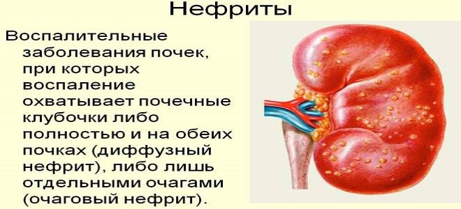 фото4 канефрон при воспалении