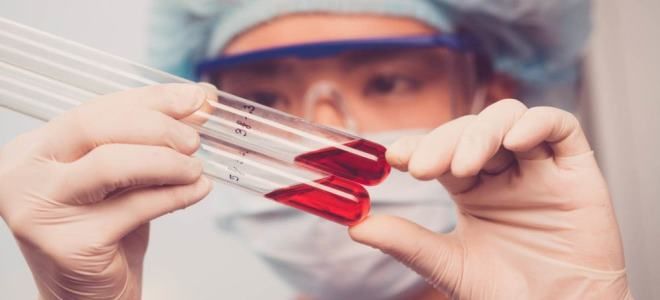 plt в общем анализе крови plt в общем анализе крови