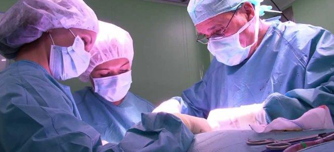 рак щитовидной железы операция рак щитовидной железы операция