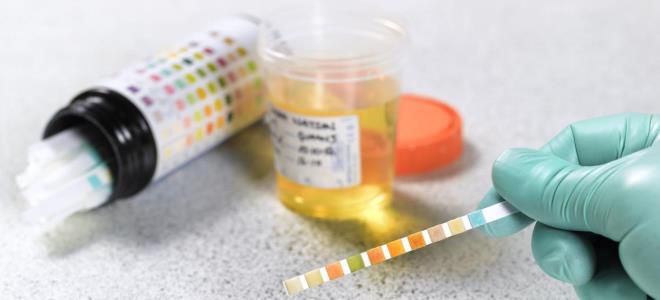 тест полоски на ацетон в моче тест полоски на ацетон в моче