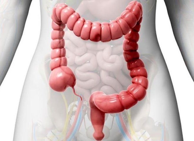 воспаление толстого кишечника воспаление толстого кишечника