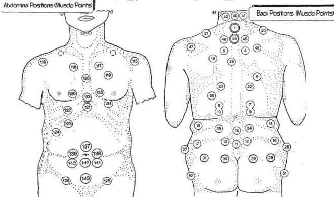 хиджама точки по сунне хиджама точки по сунне