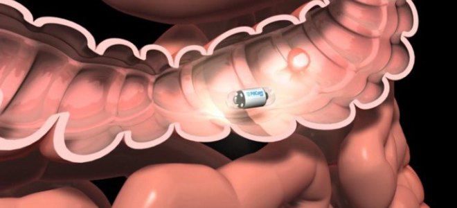 колоноскопия альтернативные методы колоноскопия альтернативные методы