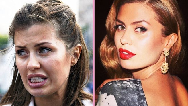 виктория боня ринопластика до и после виктория боня ринопластика до и после