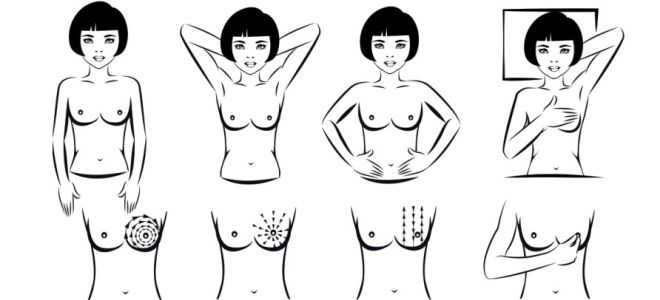 Как проводить самообследование молочных желез Как проводить самообследование молочных желез