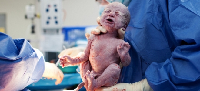 когда можно рожать после кесарева сечения