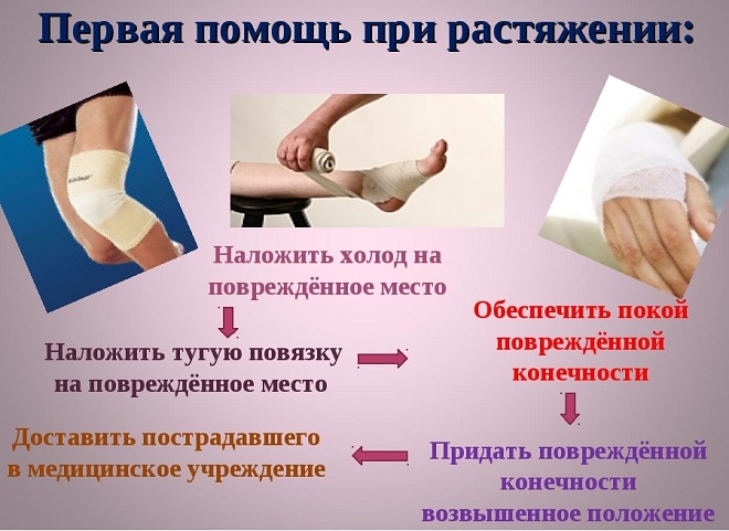 первая помощь при растяжении